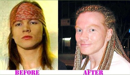 A picture of Axl Rose before (left) and after (right) disappearing from industry.